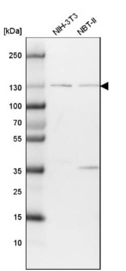 O-GlcNAcase/OGA/MGEA5 Antibody, Novus Biologicals:Antibodies:Primary Antibodies